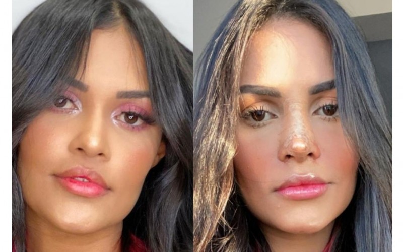 Flay sobre cirurgia plástica; 